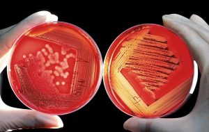 Read more about the article Vega-test – diagnostyka i eliminowanie patogenów